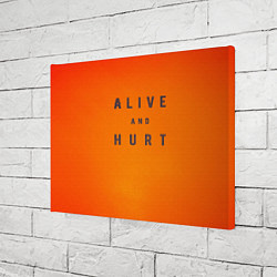 Холст прямоугольный Alive and hurt, цвет: 3D-принт — фото 2