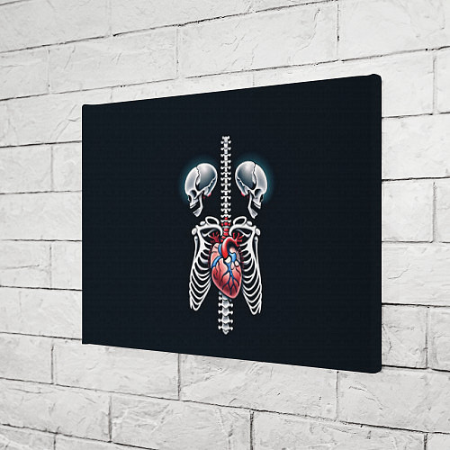Картина прямоугольная Два сросшихся скелета и сердце / 3D-принт – фото 3