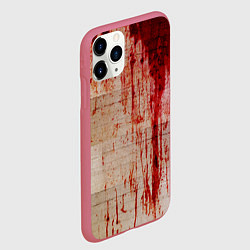 Чехол iPhone 11 Pro матовый Бинты 1, цвет: 3D-малиновый — фото 2