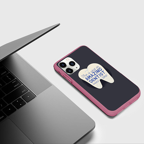 Чехол iPhone 11 Pro матовый Amazing Dentist / 3D-Малиновый – фото 3
