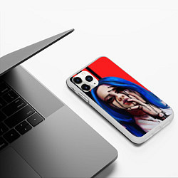 Чехол iPhone 11 Pro матовый Билли Айлиш, цвет: 3D-белый — фото 2