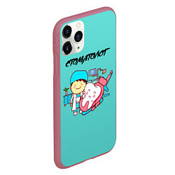 Чехол iPhone 11 Pro матовый Стоматолог, цвет: 3D-малиновый — фото 2