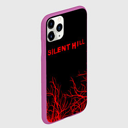 Чехол iPhone 11 Pro матовый SILENT HILL, цвет: 3D-фиолетовый — фото 2