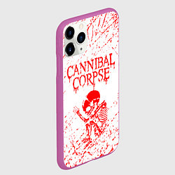 Чехол iPhone 11 Pro матовый Cannibal corpse, цвет: 3D-фиолетовый — фото 2