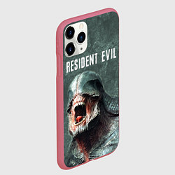 Чехол iPhone 11 Pro матовый RESIDENT EVIL 2 РЕЗИДЕНТ ЕВИЛ Z, цвет: 3D-малиновый — фото 2