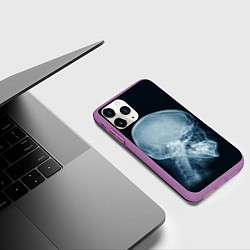 Чехол iPhone 11 Pro матовый Рентген головы, цвет: 3D-фиолетовый — фото 2