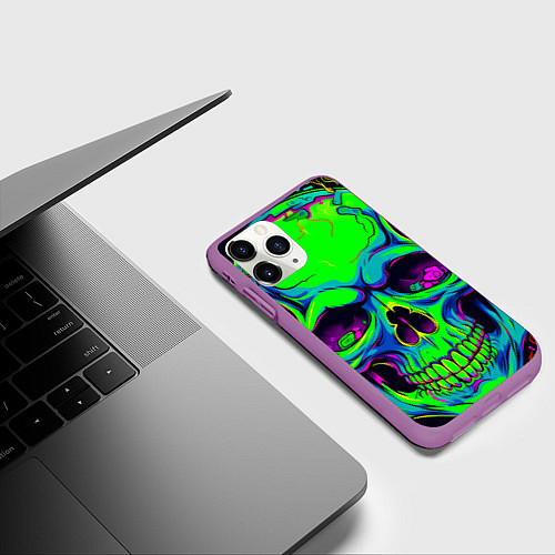 Чехол iPhone 11 Pro матовый Ярко кислотный череп в наушниках / 3D-Фиолетовый – фото 3
