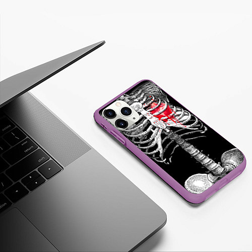 Чехол iPhone 11 Pro матовый Скелет с сердцем / 3D-Фиолетовый – фото 3