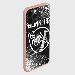 Чехол для iPhone 12 Pro Max Blink 182 КОТ Спрей, цвет: 3D-светло-розовый — фото 2