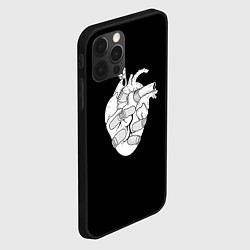 Чехол для iPhone 12 Pro Раненное-сердце, цвет: 3D-черный — фото 2