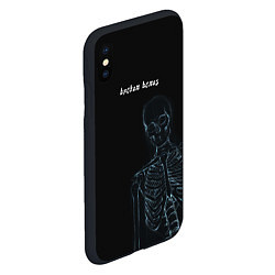 Чехол iPhone XS Max матовый Broken bones, цвет: 3D-черный — фото 2